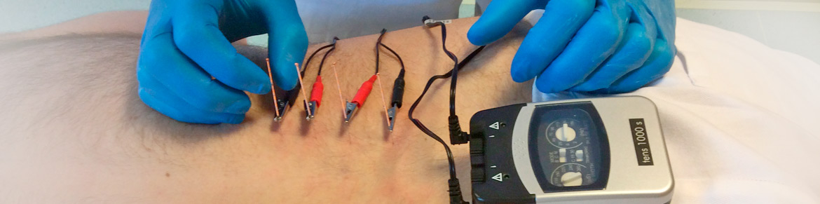 Elektro Dry Needling